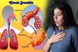 chronic bronchitis: நாள்பட்ட மூச்சுக்குழாய் அழற்சி ஆபத்தான நோயா? அறிகுறிகள் எப்படி இருக்கும்?
