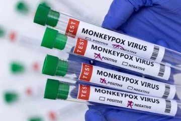 பிரபல நாடொன்றில் முதன்முறையாக ஒருவருக்கு குரங்கும்மை உறுதி!