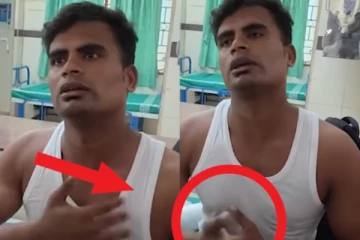 கூமாபட்டி தங்கபாண்டி எலும்பு உடைந்து மருத்துவமனையில் அனுமதி! சிங்கிள் பசங்க ஷோ முடிந்து செல்லும்போது சம்பவம்