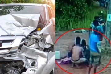 கோர விபத்தில் சிக்கிய நபரிற்கு ஏற்பட்ட துயரம்! தனியாக கழன்று சென்ற பாதம்