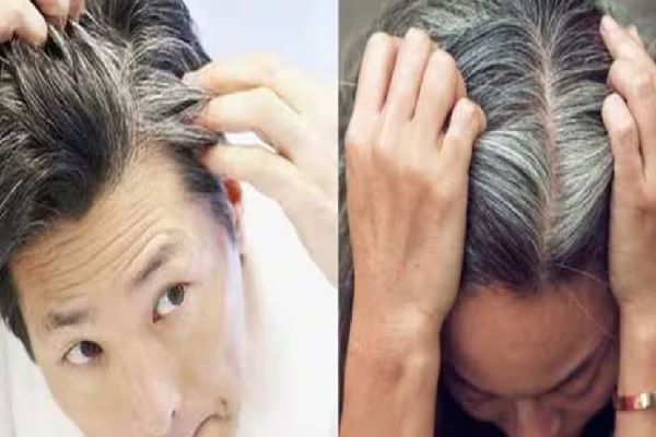 இளநரைக்கு முடிவு கட்டும் வெற்றிலை எண்ணெய் - எப்படி செய்யலாம்? | Make This Betel Leaf Oil Reduce Grey Hair Beauty