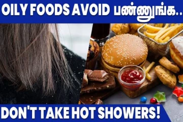 பொடுகை வீட்டிலிருந்தே சீக்கிரமாக போக்க வேண்டுமா? ஈஸியான டிப்ஸ்