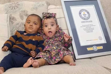 ගිනස් පොතට ගිය අසාමාන්‍ය නිවුන් දරු උපත.