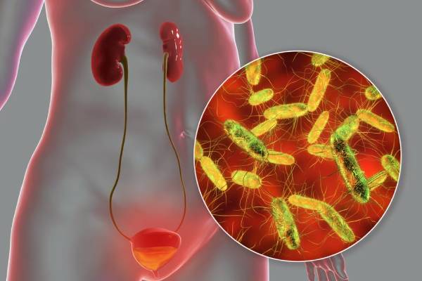 தக்காளியை அதிகமாக சாப்பிடுவதால் எந்த நோய் வரும்? | Which Disease Caused By Eating Tomatoes