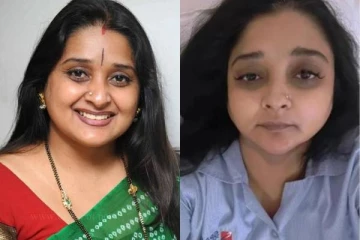 முகம் வீங்கி அடையாளம் தெரியாமல் போன மாதவன் பட நடிகை!! ஷாக்காகும் ரசிகர்கள்..