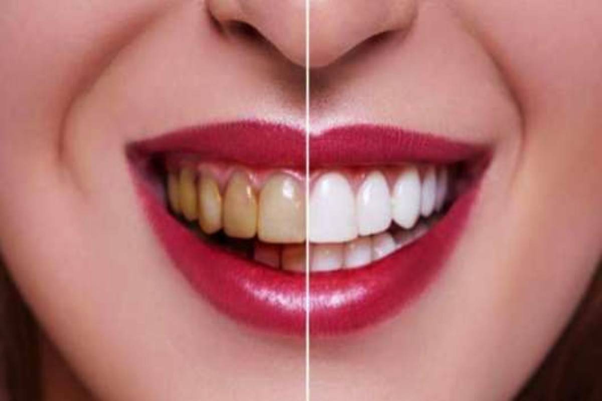 கடுகு எண்ணெயை உப்புடன் கலந்து வாய் கொப்பளித்தால் என்ன நன்மை? | Benefits Of Gargling With Mustard Oil Mixed Salt