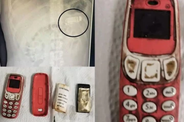 வயிற்றில் கேட்ட சத்தம்.. ஸ்கேன் செய்த மருத்துவர்களுக்கு காத்திருந்த பேரதிர்ச்சி