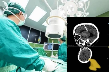 உடலில் ஏற்பட்ட பிரச்சனை: மூதாட்டியை பரிசோதித்த மருத்துவர்களுக்கு காத்திருந்த அதிர்ச்சி!