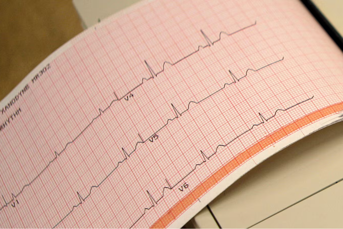 கனடாவில் இளம் வயதினர் தொடர்பில் விடுக்கப்படும் எச்சரிக்கை | Heart Failure Rising Among Younger Canadians