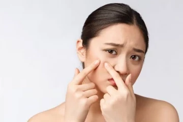 White heads உங்களை தொந்தரவு செய்கிறதா? அவற்றை அகற்ற இந்த 3 விரைவான வழிகளை முயற்சிக்கவும்