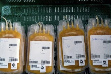 கொரோனாவுக்கு ப்ளாஸ்மா சிகிச்சை: உலக சுகாதார அமைப்பு புதிய அறிவுறுத்தல்