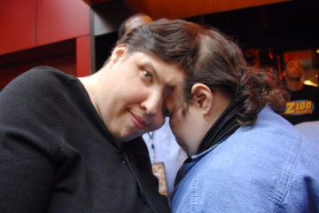 உலகின் வயது முதிர்ந்த ஒட்டிப் பிறந்த இரட்டையர் மரணம்