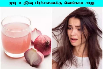 முடி கொட்டும் பிரச்சனை உடனே சரியாகனுமா? வெங்காயம் மட்டும் போதும்