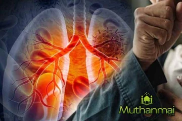 நாட்டில் வேகமாக அதிகரித்து வரும் நோய்: வைத்தியர்கள் விடுத்துள்ள எச்சரிக்கை