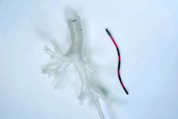 புற்றுநோய் சிகிச்சையில் புரட்சி! சிகிச்சைக்கு உதவும் 2 மிமீ ரோபோ