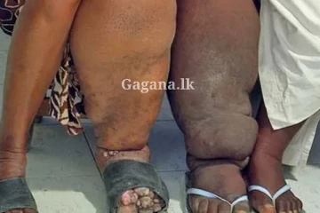 තවත් රෝගයක, රෝගීන්ගේ ඉහළ යාමක්.