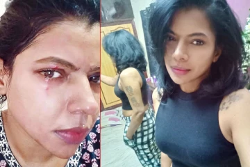 அக்காவ அடிச்சது யாருடா.. நடிகை காஜல் பசுபதி முகத்தில் திடீர் ரத்த காயம்