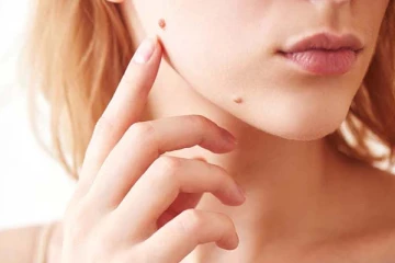 இந்த அபூர்வ மச்சம் உங்களுக்கு இருக்கின்றதா? அப்போ கோடீஸ்வர் யோகம் நிச்சயம்