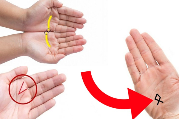 உடம்புல இந்த இடத்துல மச்சம் இருக்கா? யாருக்கும் கிடைக்காத அதிர்ஷ்டம் உங்ககிட்ட இருக்கும்! | Mole Astrology Moles Unravel Your Destiny