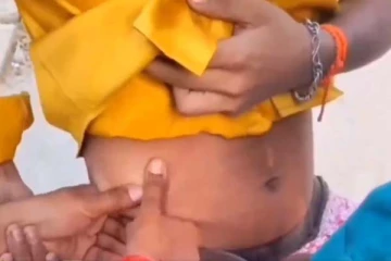 வெறும் கையை வைத்து கிட்னியில் இருந்து கல் எடுக்கிறாங்களா? கொந்தளிச்சிடாதீங்க மக்களே