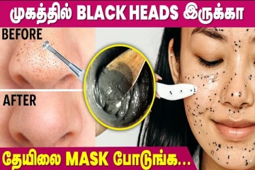முகத்தில் உள்ள கரும்புள்ளியை நீக்க இதை செய்து பாருங்க போதும்