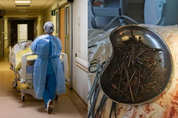 குடிபழக்கத்தை விட்டவர் வயிற்றில் கிலோ கணக்கில் இருந்த உலோகப் பொருட்கள்! மிரண்டு போன மருத்துவர்கள்