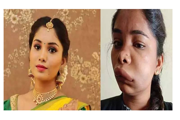 பல் சிகிச்சைக்காக சென்ற சீரியல் நடிகைக்கு ஏற்பட்ட விபரீதம் - வீட்டில் இருந்து கதறல்; அதிர்ச்சி புகைப்படம்! | Dental Treatment Effect Serial Actress Face Swathi