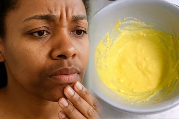 வாயை சுற்றியுள்ள கருமையை நீக்க உதவும் பேக்.., எப்படி தயாரிப்பது?