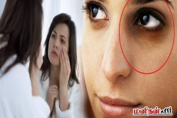 கண்களின் அழகை கெடுக்கும் கருவளையங்களை நிரந்தரமா நீக்கணுமா? இயற்கை முறையில் தீர்வு!