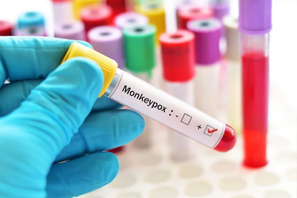 தலைதூக்கும் குரங்கம்மை பாதிப்பு : 6 பேர் பலி | 6 People Die Of Monkeypox In Vietnam