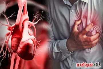 இந்த 3 அறிகுறிகளை புறக்கணித்தால் மாரடைப்பு உறுதி! எச்சரிக்கும் மருத்துவர்கள்