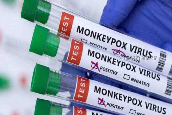 கனடாவின் குரங்கம்மை நிலவரம் | Monkeypox Infections Decreasing Canada Phac