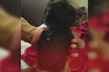 விசித்திர தோற்றத்துடன் பிறந்த குழந்தை; அதிர்ச்சியில் மருத்துவர்கள்!