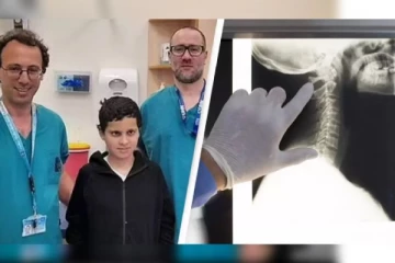 சிறுவனின் தலையை அறுவை சிகிச்சையில் ஒட்டவைத்து இஸ்ரேல் மருத்துவர்கள் சாதனை: குவியும் பாராட்டு