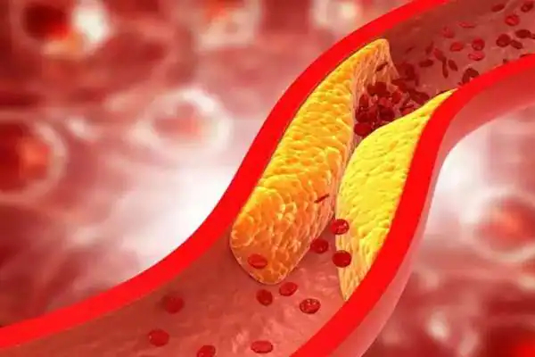 எச்சரிக்கை; இந்த நோயுள்ளவர்களுக்கு தக்காளி விசமாகுமாம்! | Tomatoes Health Tips