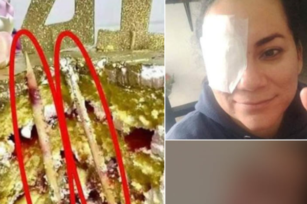 மகிழ்ச்சியாக இருந்த பெண்ணுக்கு காத்திருந்த பேரதிர்ச்சி! நொடியில் வலியால் துடித்துடித்த அவலம் | Woman S Face Smashed Into Cake Narrowly Escapes