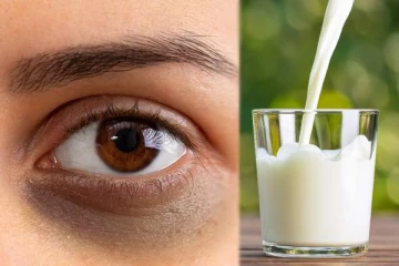 கருவளையம் நீங்க குளிர்ந்த பால்: மருத்துவர் கூறும் செய்தி