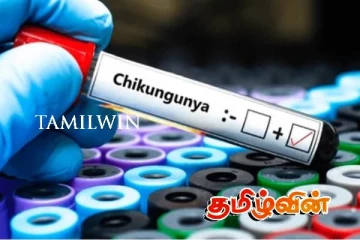 இலங்கையில் வேகமாக பரவும் வைரஸ்: எச்சரிக்கும் மருத்துவர்கள்