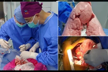 சீன மருத்துவர்கள் படைத்த சாதனை