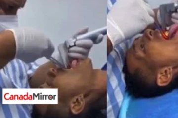 இளைஞரின் வாய்க்குள் உயிருடன் சென்ற 7 இன்ச் மீன்; அதிர்ந்த மருத்துவர்கள்