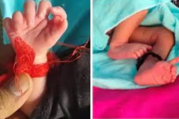 26 விரல்களுடன் பிறந்த அதிசய குழந்தை: தேவியின் அவதாரமாக கருதும் குடும்பத்தினர்