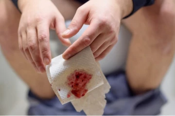 ඔබටත් මළපහ තුළ රුධිරය පිටවෙනවාද..? ඒසේ ඇතිවීමට පොදු හේතු 10ක් ..