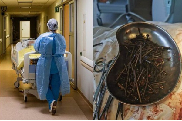 தீராத வயிற்று வலியால் அவதிப்பட்டு வந்த நபர் - ஸ்கேன் செய்து பார்த்த மருத்துவர்கள் அதிர்ச்சி - நடந்தது என்ன? | World Scan Test Abdominal Pain