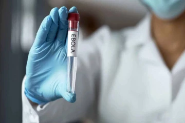 காங்கோவில் எபோலா பலி எண்ணிக்கை 2,325 ஆக உயர்வு