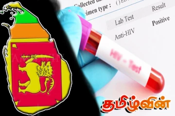 நாட்டிலுள்ள இளைஞர்களிடையே அதிகரிக்கும் நோய் நிலைமை: சுகாதார அமைச்சின் தகவல்