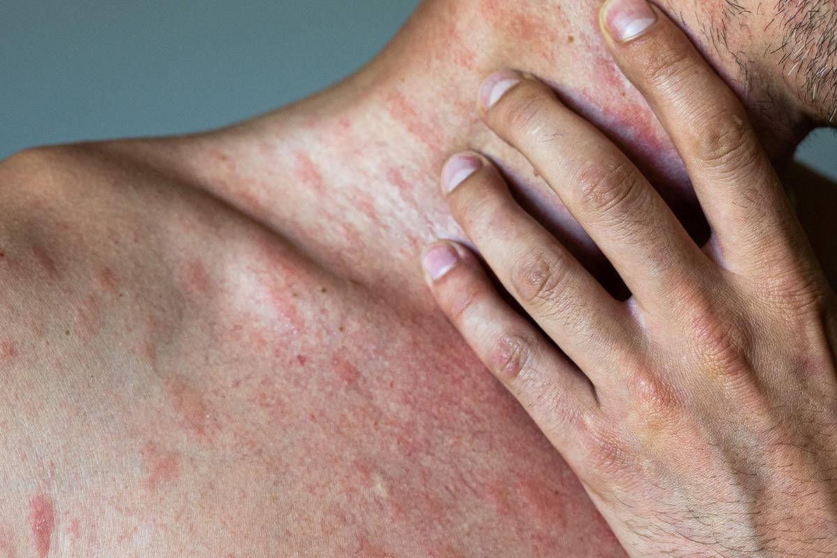 காலையில் எழுந்ததும் கண்களில் நீர் வடியுதா? இந்த நோய் தான் காரணம் | This Disease Causes Watery Eyes In The Morning