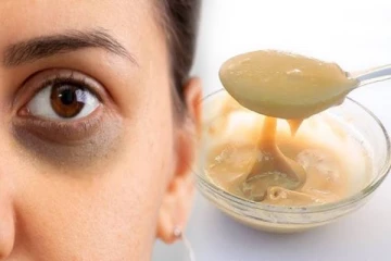 ஒரே வாரத்தில் கருவளையம் நிரந்தரமாக நீங்க உதவும் எளிய வீட்டு வைத்தியம்