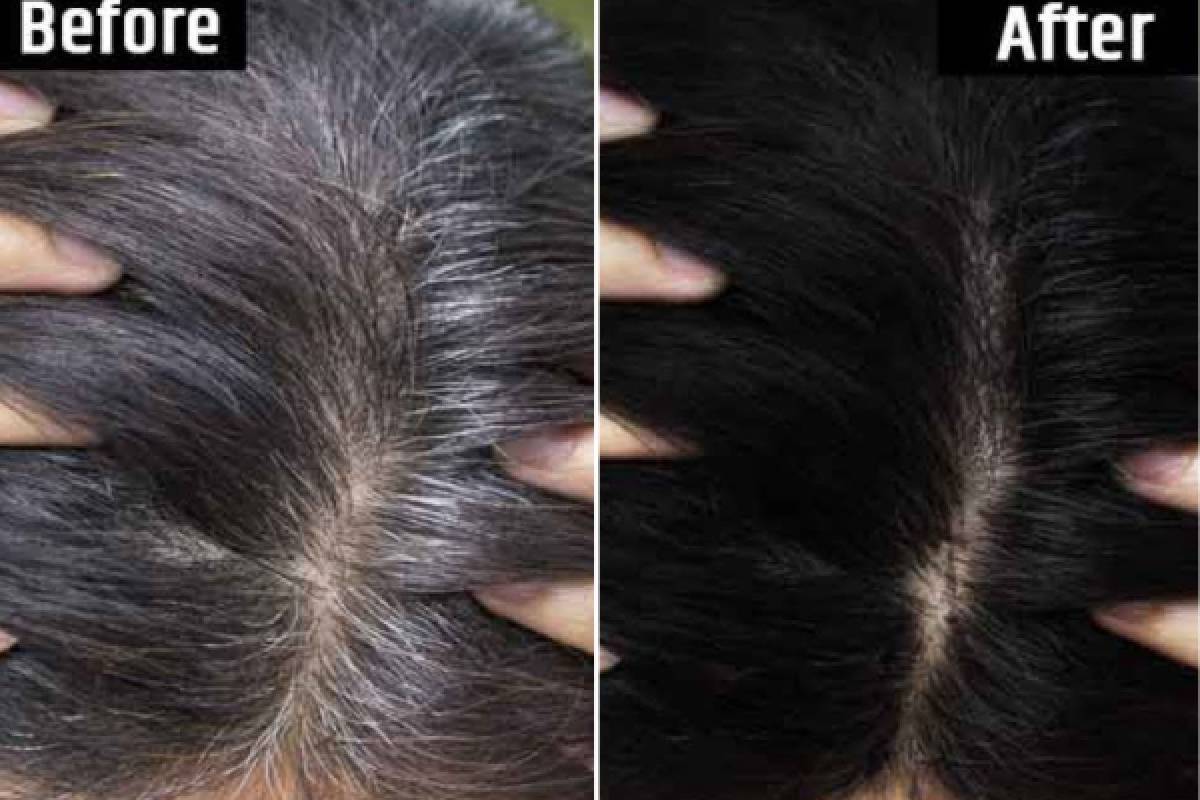 natural home remedies : நரைமுடி பிரச்சினைக்கு இயற்கை தீர்வு! வீட்டிலேயே செய்யக்கூடிய எளிய பராமரிப்புகள் | Best Home Remedies For Gray Hair natural home remedies : நரைமுடி பிரச்சினைக்கு இயற்கை தீர்வு! வீட்டிலேயே செய்யக்கூடிய எளிய பராமரிப்புகள் | Best Home Remedies For Gray Hair