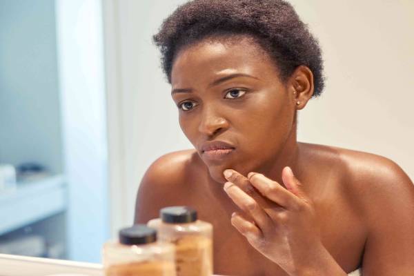 மருக்களை அடியோடு அகற்றும் சாறு.. இனியும் அலட்சியம் வேண்டாம்! | Causes Of Warts On The Body