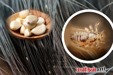 தலையில் இருக்கும் பேன் தொல்லைக்கு - பூண்டு இருந்தா இதனுடன் அரைத்து பூசுங்க